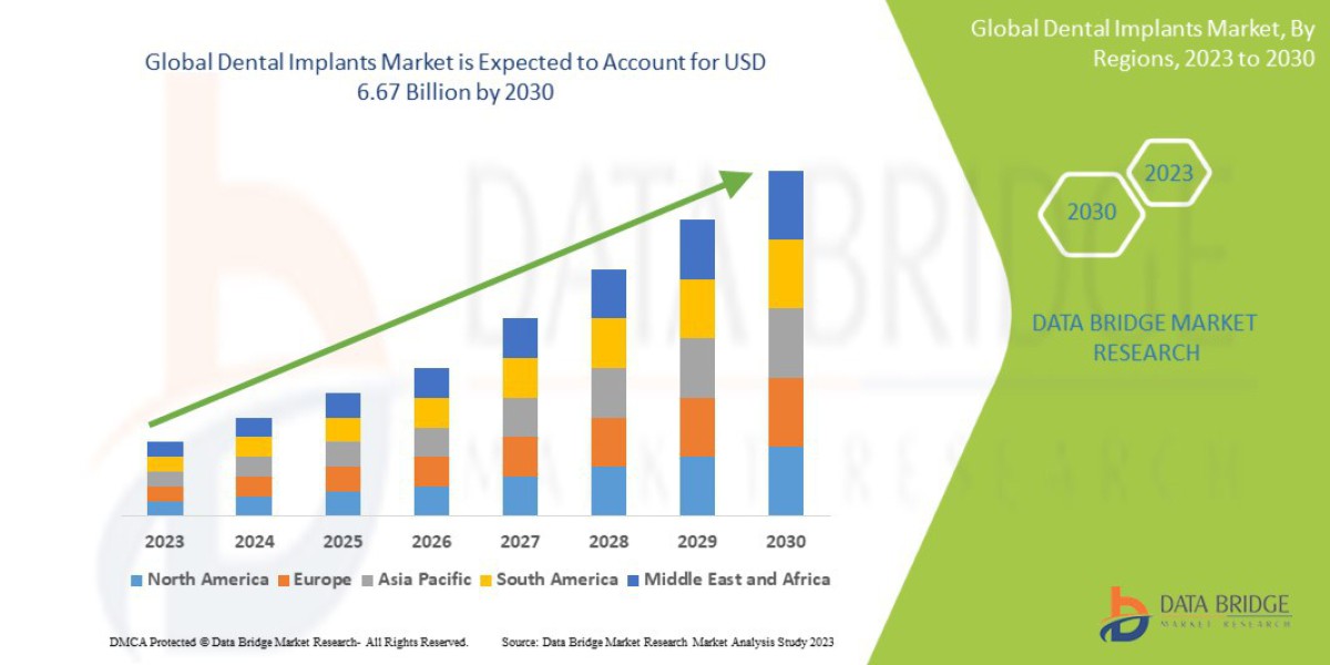 Europe Dental Implant Market Set for Robust Growth Driven by Aging Population and Advancements in Oral Care Technology